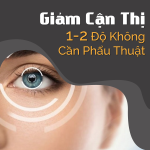 Giảm Cận Thị 1-2 Độ Không Cần Phẫu Thuật
