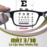 Mắt 3/10 Là Cận Bao Nhiêu Độ