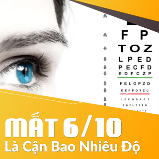 Mắt 6/10 Là Cận Bao Nhiêu Độ