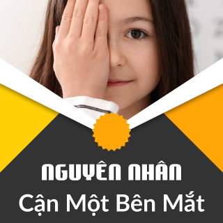 Nguyên Nhân Và Cách Xử lý Cận Một Bên Mắt
