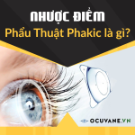 Nhược Điểm Của Phẫu Thuật Phakic Là gì?